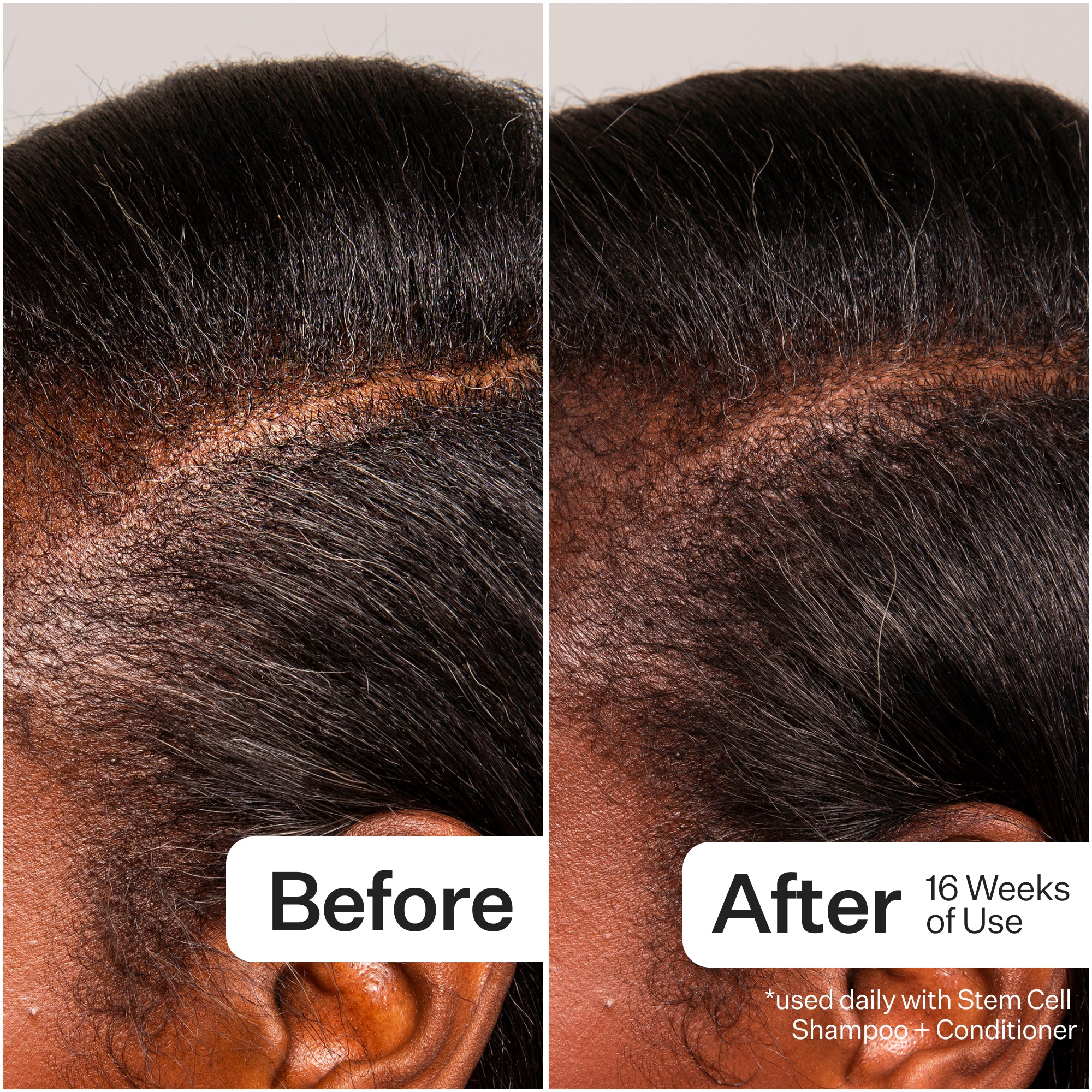 Side-by-side comparison of hair before and after 16 weeks of using a hair care product, showing noticeable improvement in thickness and fullness.
